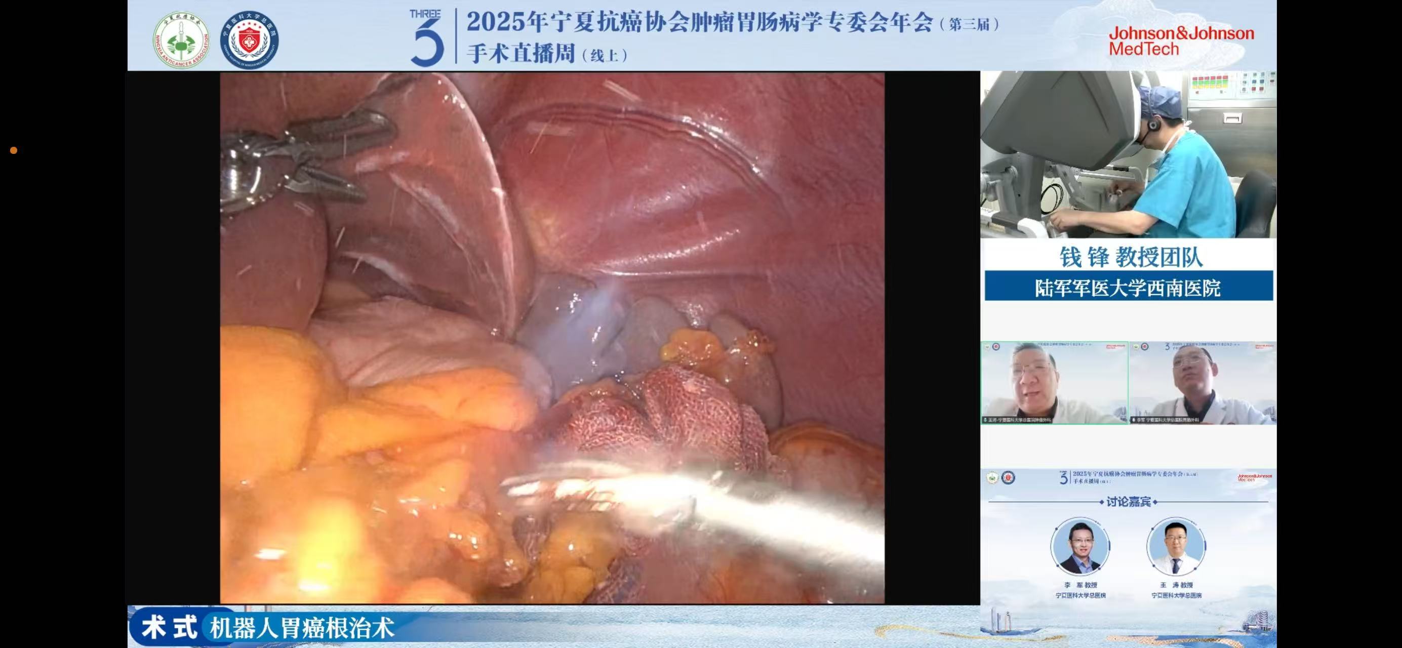 机器人手术直播.jpg